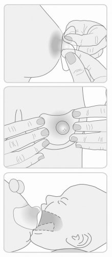 Lansinoh szilikon bimbóvédő normál 2db